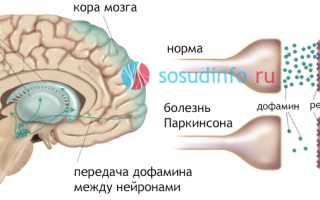 Болезнь Паркинсона: причины возникновения, проявления, стадии, лечение