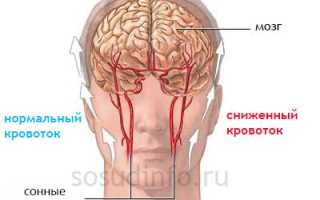 Спазм сосудов головы: причины, как снять и лечить?