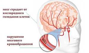 Заболевания мозга и сосудов головы, цереброваскулярная диагностика, анатомия, фармакология