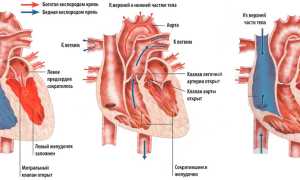 Сердечные тоны: понятие, аускультация, о чем говорят патологические