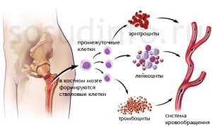 Полицитемия (эритремия, болезнь Вакеза): причины и развитие, проявления, лечение, прогноз