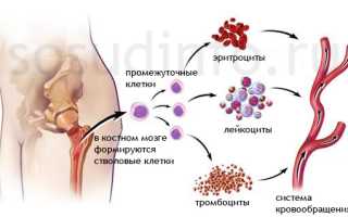 Полицитемия (эритремия, болезнь Вакеза): причины и развитие, проявления, лечение, прогноз