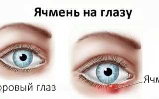 Тетрациклиновая мазь: инструкция по применению для глаз