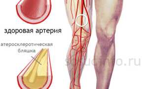 Сосудистые болезни ног: какие бывают и как их лечить?