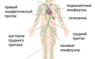 Лимфангит (воспаление лимфатических сосудов): как развивается, симптоматика, как лечить