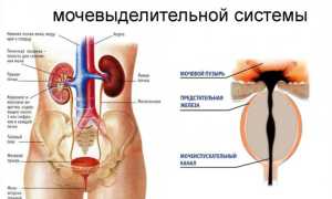 Камень в мочеточнике – симптомы, причины и лечение у женщин