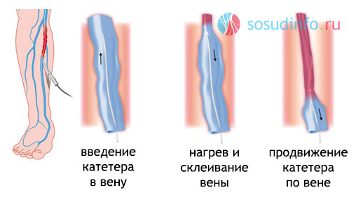 465446886468