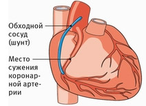 466886648