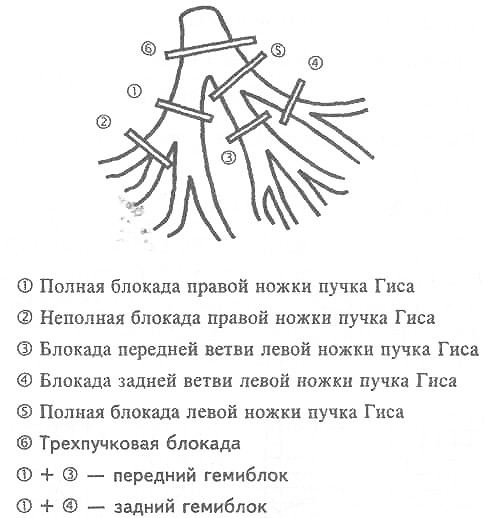 46884864