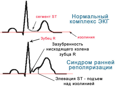 486486846486486