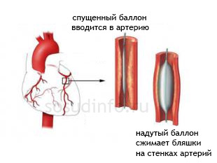 48948894