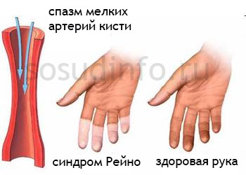 545454545