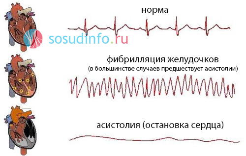 54648486486
