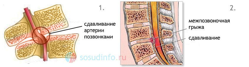 54654486864