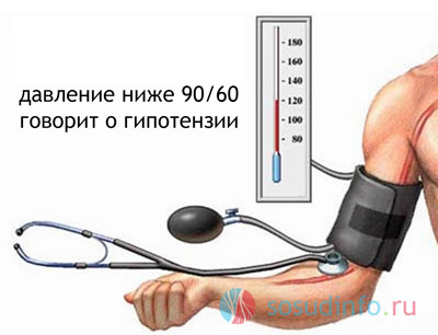артериальная гипотензия - гипотония низкое давление, симптомы