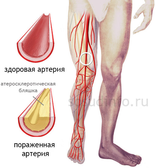 546546