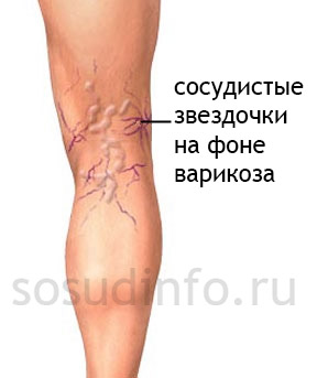54654645468