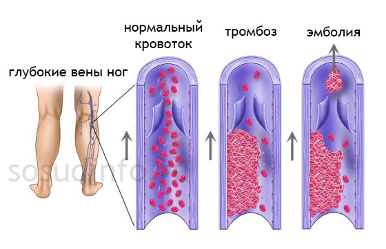 5465468486