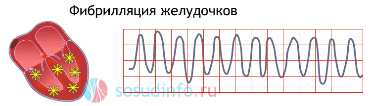 54664484684