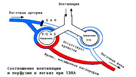54684648486