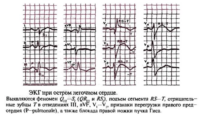 5468468486846