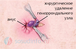 5468468648