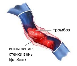 5468484846