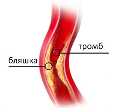 5468486