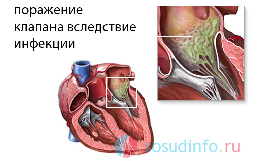 5468486486486