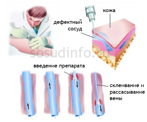 5468684868846