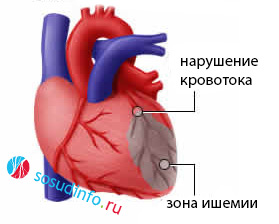 5468846486