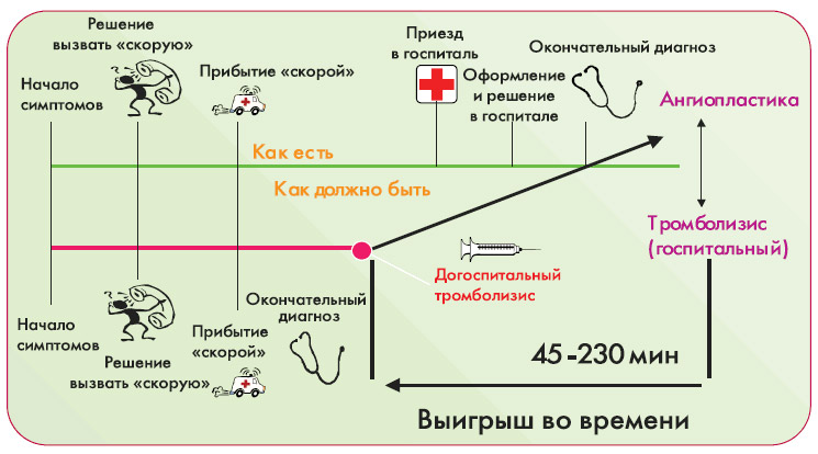 Что дает тромболизис на догоспитальном этапе?