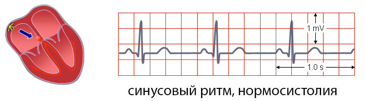 546884684846