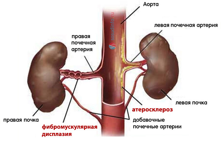 54688644486