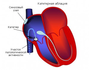 546886468468-300x235