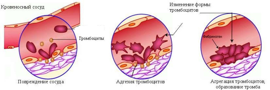 5468864846