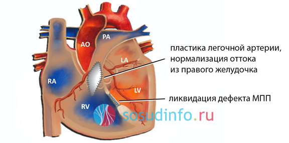 54868646868