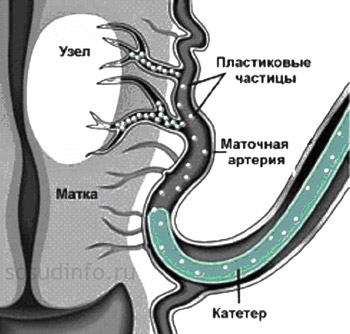 548844