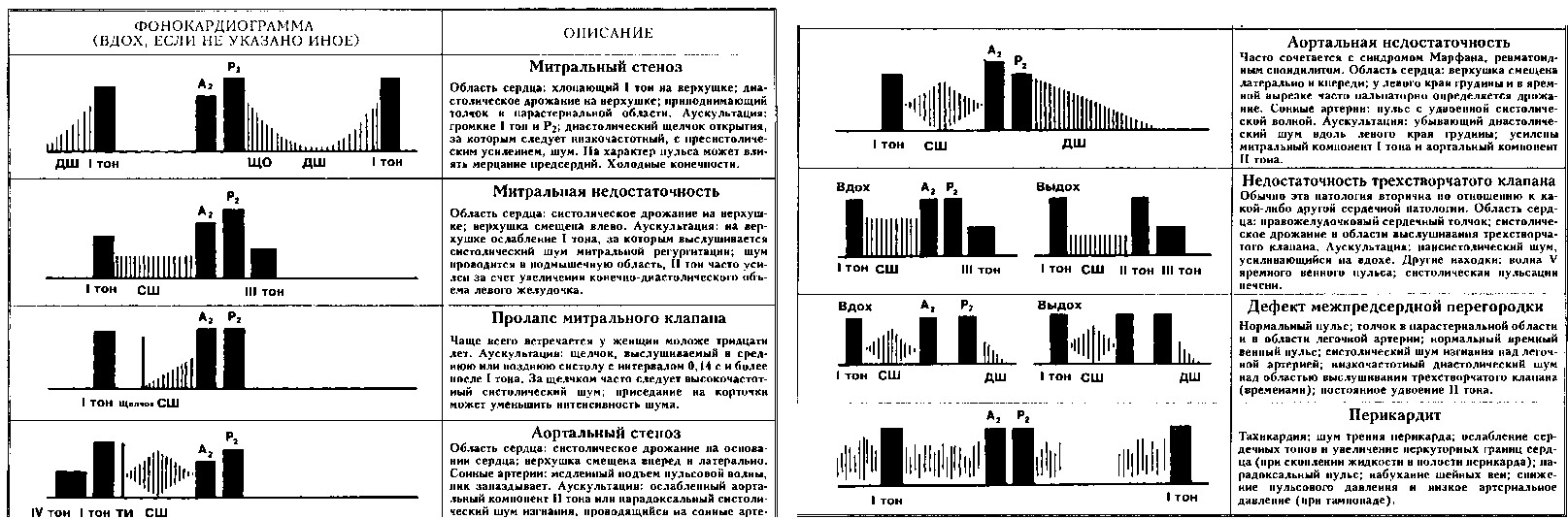 рисунок: сердечные патологии и их "шумовое" отражение