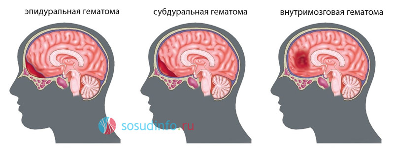 58679058069785968999
