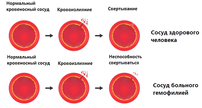 58684846